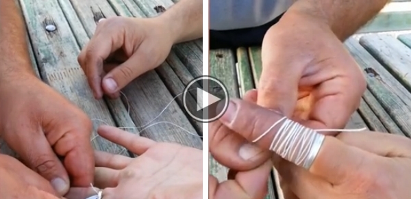 How To Remove A Ring Stuck On Your Finger.